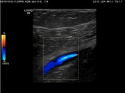 l3-12-vasc07-start-image.jpg