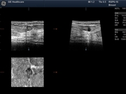 rsp6-16-brstsectpl.jpg