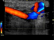 vascular-lower-ext-2.jpg