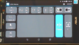  LOGIQ E10 - Photo Assistant 