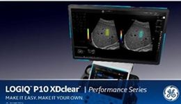 LOGIQ P10 XDclear Brochure