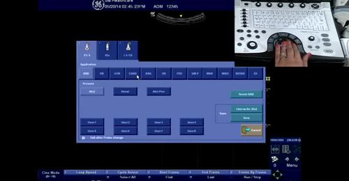 LOGIQ e - Select exam & transducer type